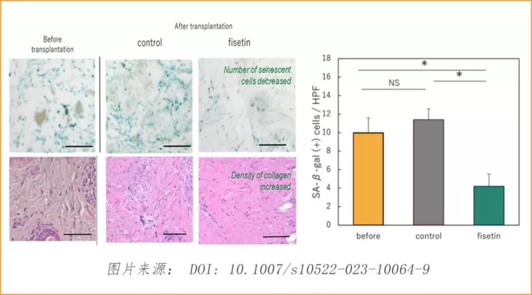 Multiple Health Benefits of Fisetin Multiple Health Benefits of Fisetin