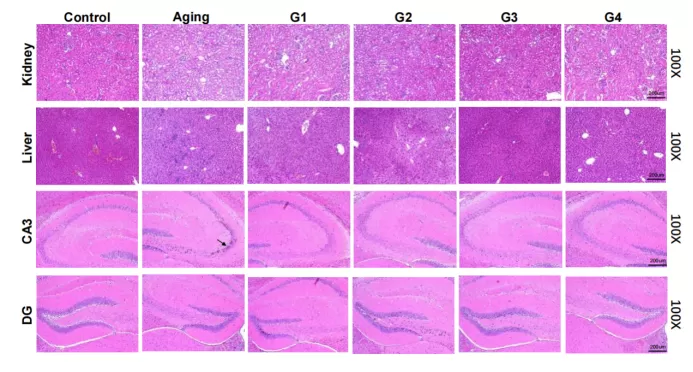 Вынуждающие результаты в модели естественного старения