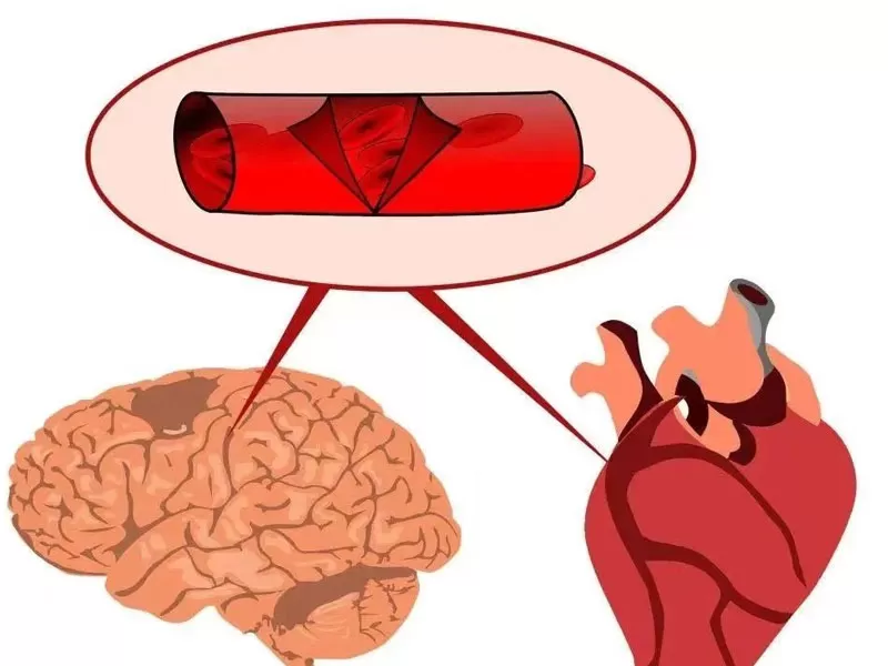 Анти-старения серии: Ресвератрол