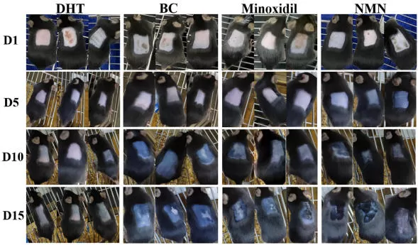 NMN и рост волос: новые доказательства андрогенетической алопеции (AGA)